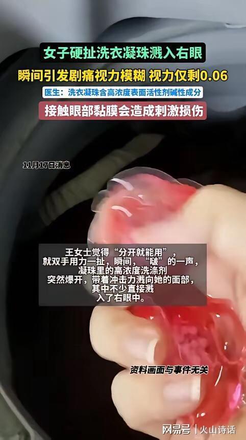 杭州一女子撕扯凝珠发生意外致眼睛失明开元棋牌试玩恐怖！洗衣引发“爆炸”(图2)